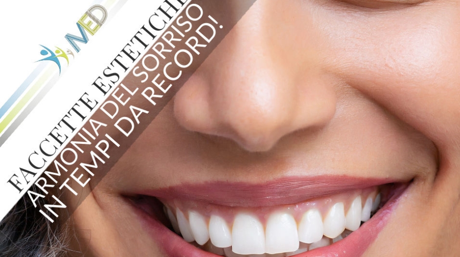 Faccette estetiche: un sorriso luminoso e armonioso in pochi passi!