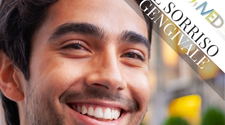 Il Sorriso Gengivale: Cause e Soluzioni